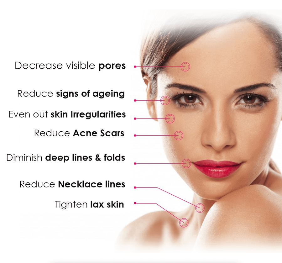 Results of Face Lift